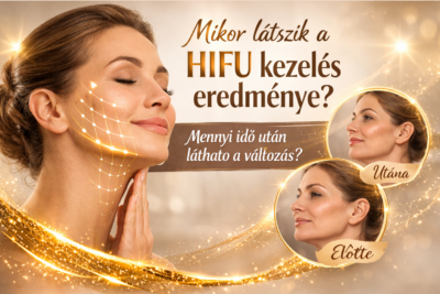 HIFU kezelés eredménye mikor látszik – arcfeszesítés Debrecenben