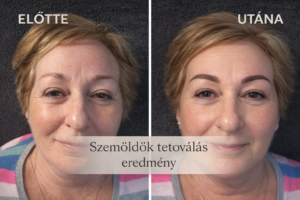 Szemöldök tetoválás előtte utána természetes hatás Debrecen